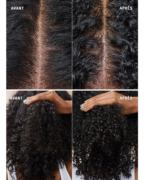 Voyez la différence lors de l’utilisation de scalp solutions