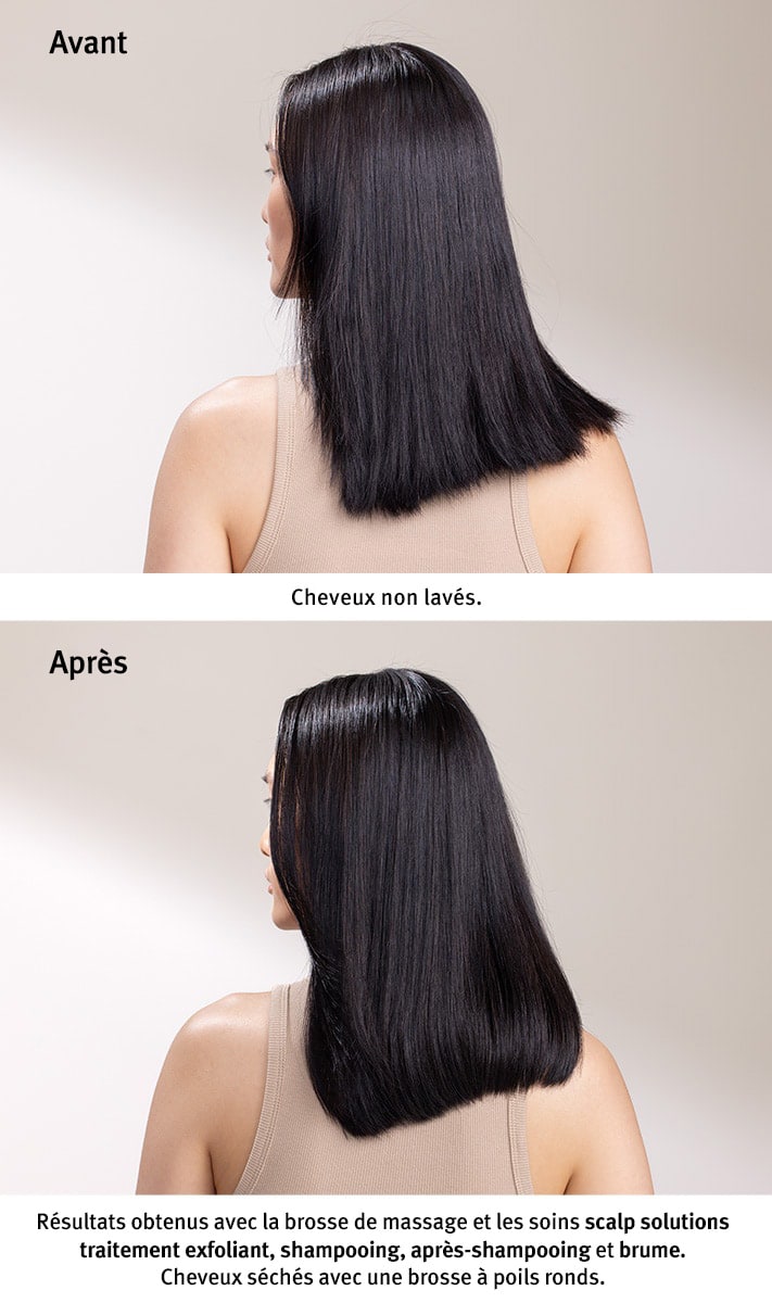 masseur stimulant le cuir chevelu scalp solutions