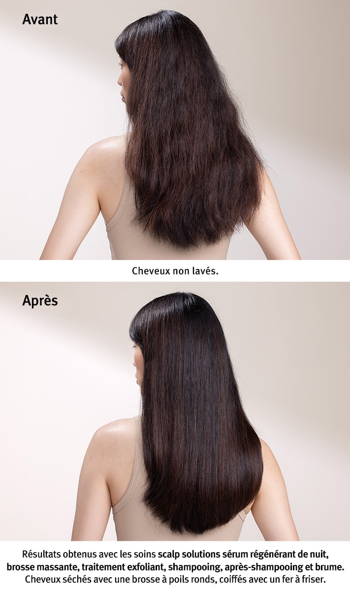 masseur stimulant le cuir chevelu scalp solutions