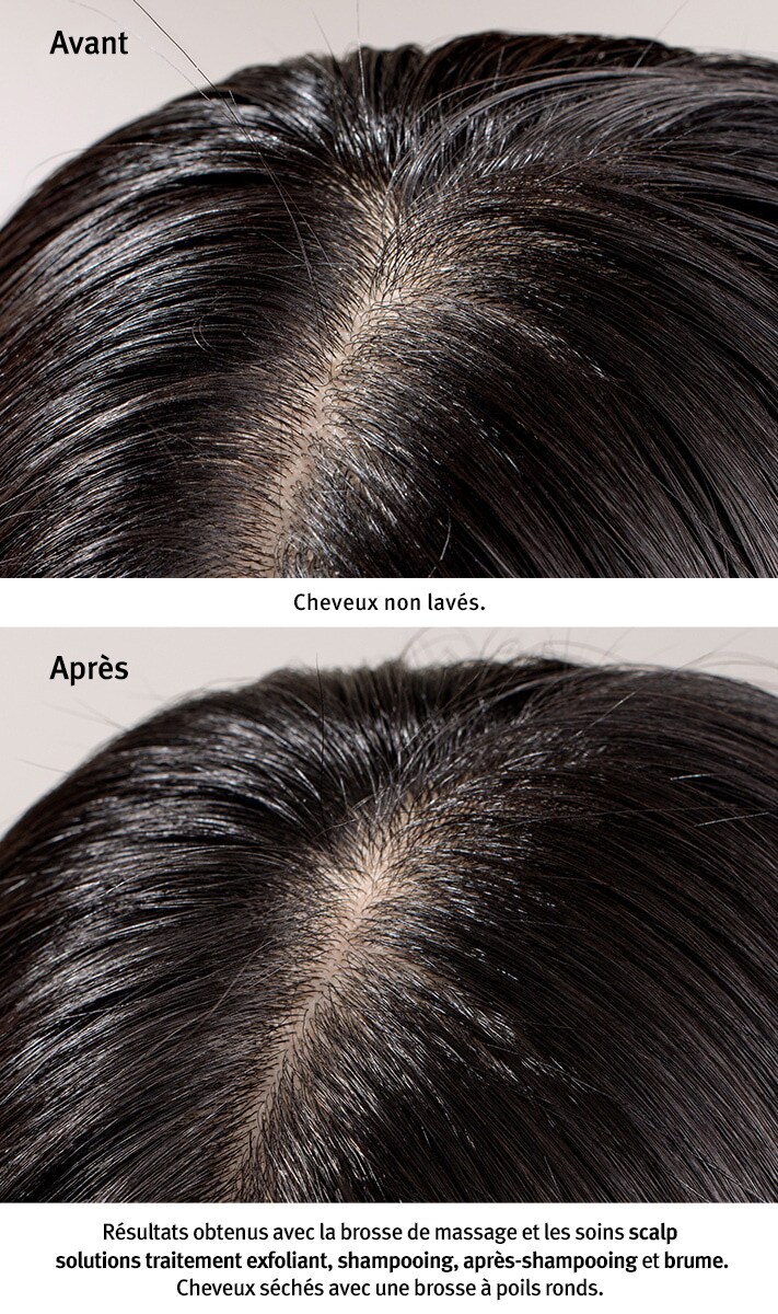 masseur stimulant le cuir chevelu scalp solutions