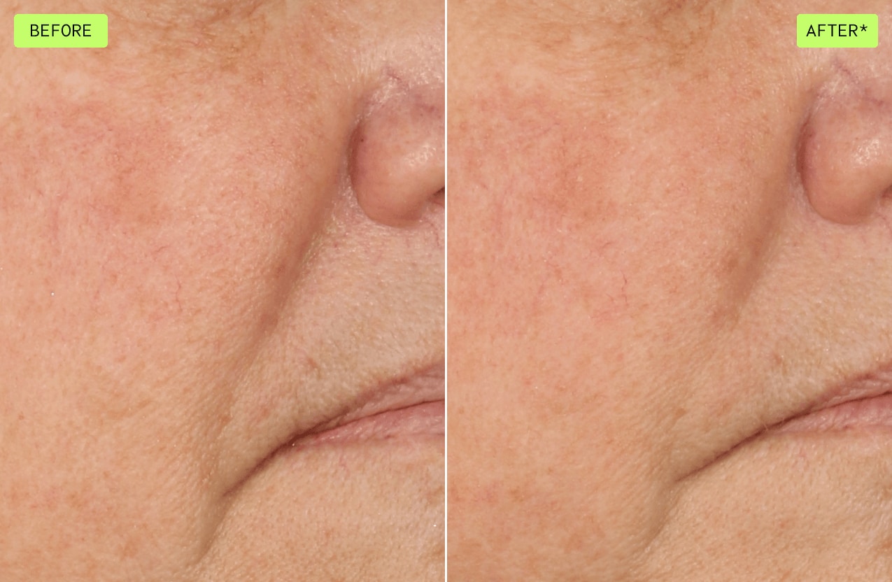 Voyez la différence lors de l’utilisation de botanical repair